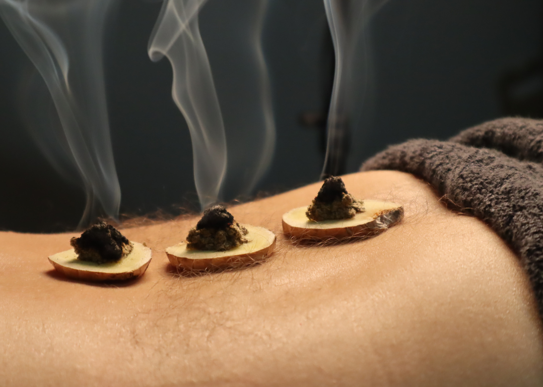 Advanced Acupuncture
